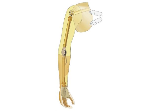 Passive Arm Prosthesis